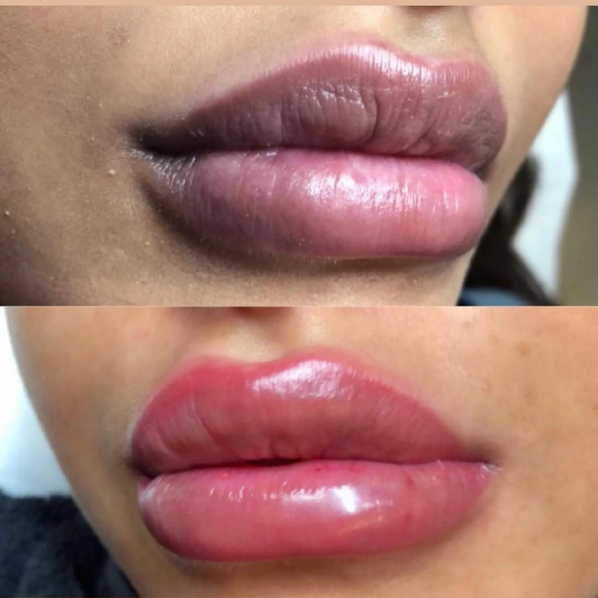 lip tattoo fading timeline